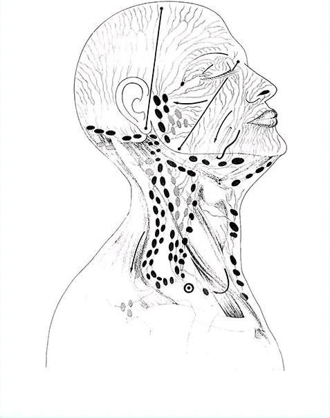 Diagram of lymphatic drainage pathways in the head and neck, lateral view